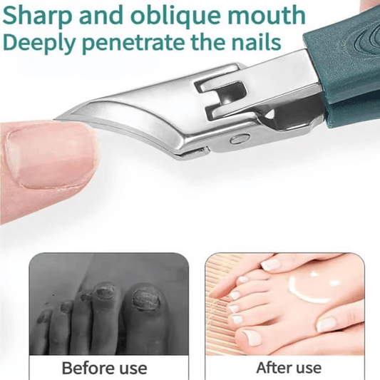 🔥🔥Nail clippers recommended by podiatrists🏥